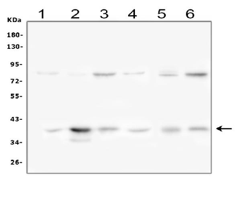 Anti-IKB alpha/NFKBIA Antibody