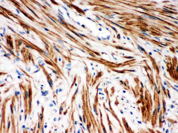 Anti-IKB beta/NFKBIB Antibody