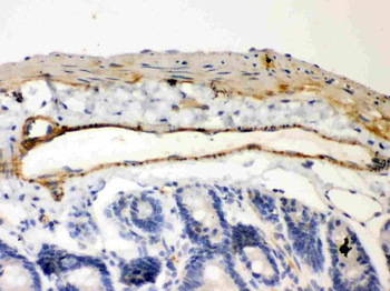 Anti-IKB beta/NFKBIB Antibody