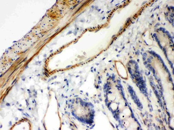 Anti-IKB beta/NFKBIB Antibody