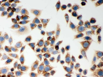 Anti-CARD4/NOD1 Antibody