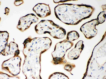 Anti-CARD4/NOD1 Antibody