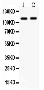 Anti-CARD4/NOD1 Antibody