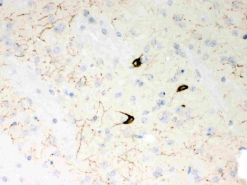 Neuropeptide Y/NPY Antibody