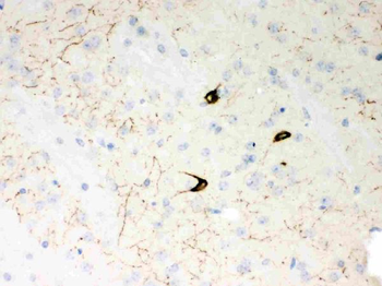 Anti-Neuropeptide Y/NPY Antibody