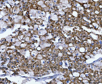 Anti-NUMB Antibody