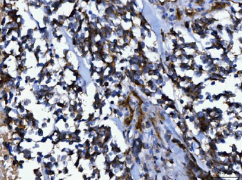 Anti-NUMB Antibody