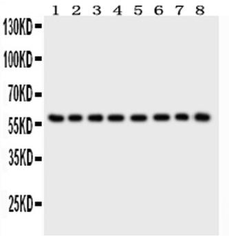 Anti-P2X2/P2RX2 Antibody