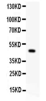 P2X5/P2RX5 Rabbit Polyclonal Antibody