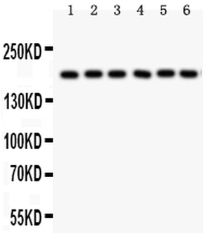 Anti-PAPP A/PAPPA Antibody