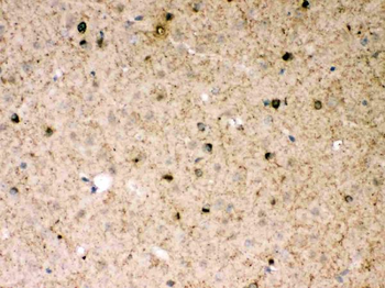 Anti-Parkin/PRKN Antibody