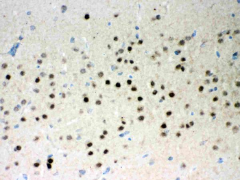 Anti-Parkin/PRKN Antibody