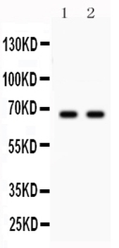 Anti-Parkin/PRKN Antibody