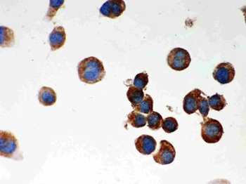 Anti-Parkin/PRKN Antibody