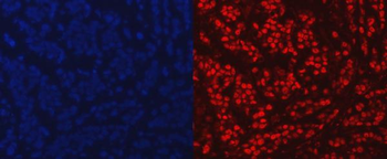 Anti-PARP/PARP1 Antibody