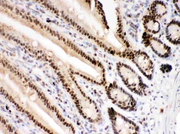 PARP/PARP1 Antibody