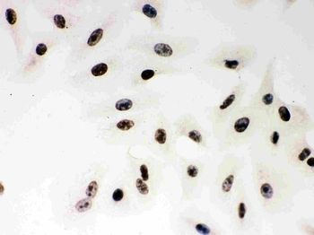 Anti-PARP/PARP1 Antibody