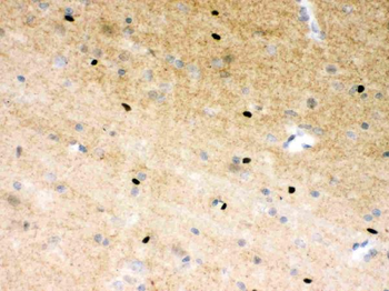 Anti-PARP/PARP1 Antibody