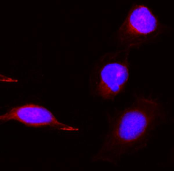 Anti-PBK Antibody