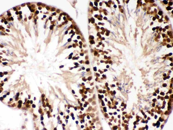 Anti-PBK Antibody