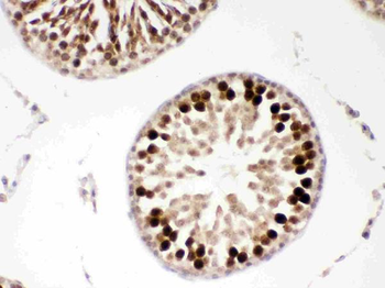Anti-PBK Antibody