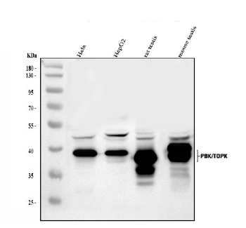 Anti-PBK Antibody