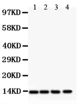 PDGF beta/PDGFB Rabbit Polyclonal Antibody