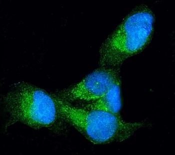 Profilin 1/PFN1 Antibody