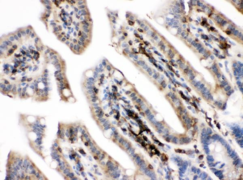 Anti-PKC alpha/PRKCA Antibody
