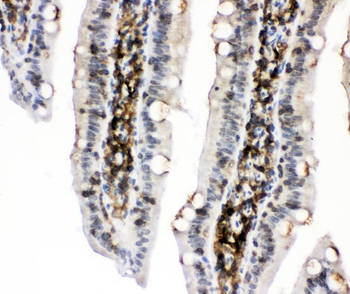Anti-PKC alpha/PRKCA Antibody