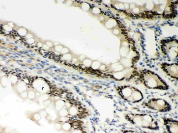 PKC epsilon/PRKCE Rabbit Polyclonal Antibody