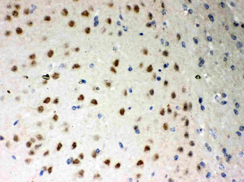 Anti-PKC iota/PRKCI Antibody