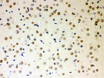 Anti-PKC iota/PRKCI Antibody