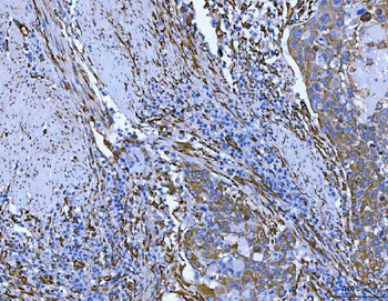Anti-Hsp47/SERPINH1 Antibody