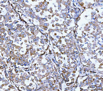Anti-Hsp47/SERPINH1 Antibody