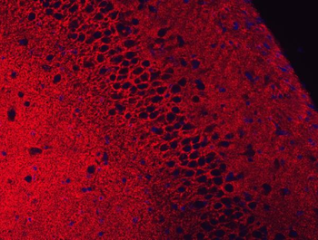 Anti-EAAT2/GLT-1/SLC1A2 Antibody