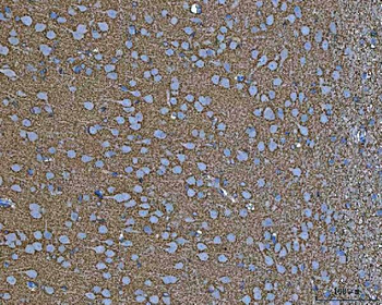 Anti-EAAT2/GLT-1/SLC1A2 Antibody