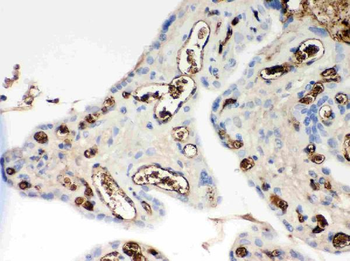 Anti-Apolipoprotein E/APOE Antibody