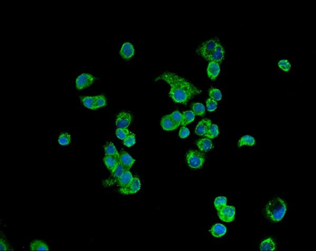 ATP5H Rabbit Polyclonal Antibody