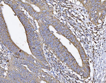 ATP5H Rabbit Polyclonal Antibody