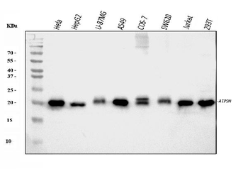 ATP5H Rabbit Polyclonal Antibody
