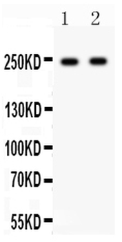 Anti-CaV1.3/CACNA1D Antibody