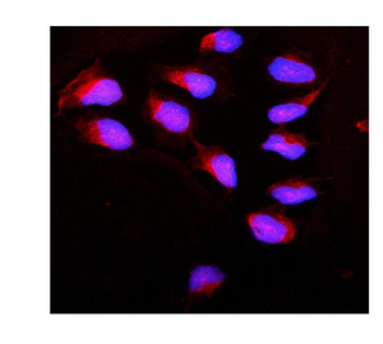 Anti-Calpain 1/CAPN1 Antibody