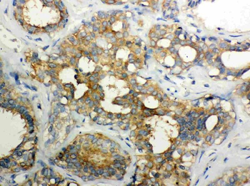Anti-Calpain 1/CAPN1 Antibody
