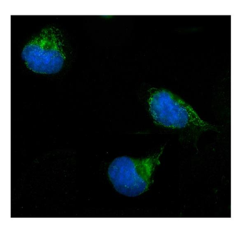 Anti-ERAB/HSD17B10 Antibody