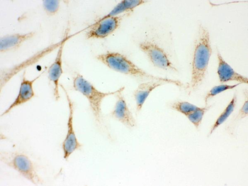 Anti-ERAB/HSD17B10 Antibody