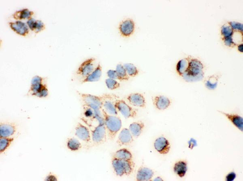 Anti-ERAB/HSD17B10 Antibody