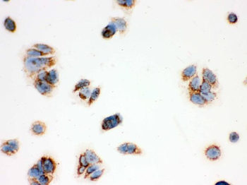 Anti-ERAB/HSD17B10 Antibody