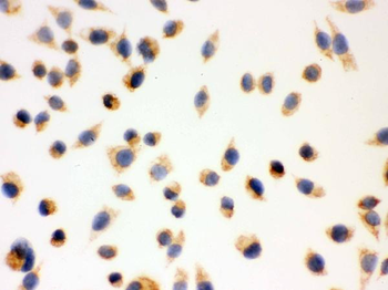 Anti-ERAB/HSD17B10 Antibody