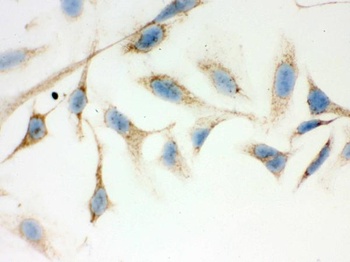 ERAB/HSD17B10 Antibody